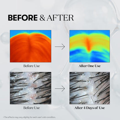 Hair Ampoule Micro-Shot